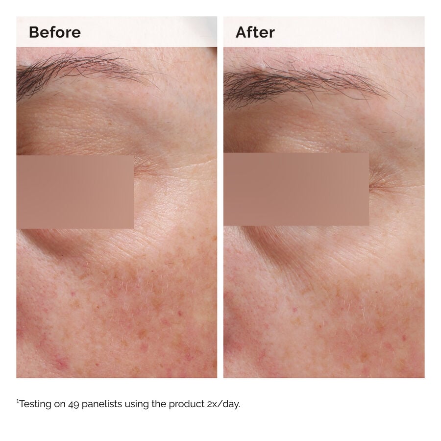 niacinamide-5-face-and-body-emulsion-h4 2024-08-23-ORD-Nia-5pct-Face-Body-B-A-Elasticity-Global-02-1x1.jpg