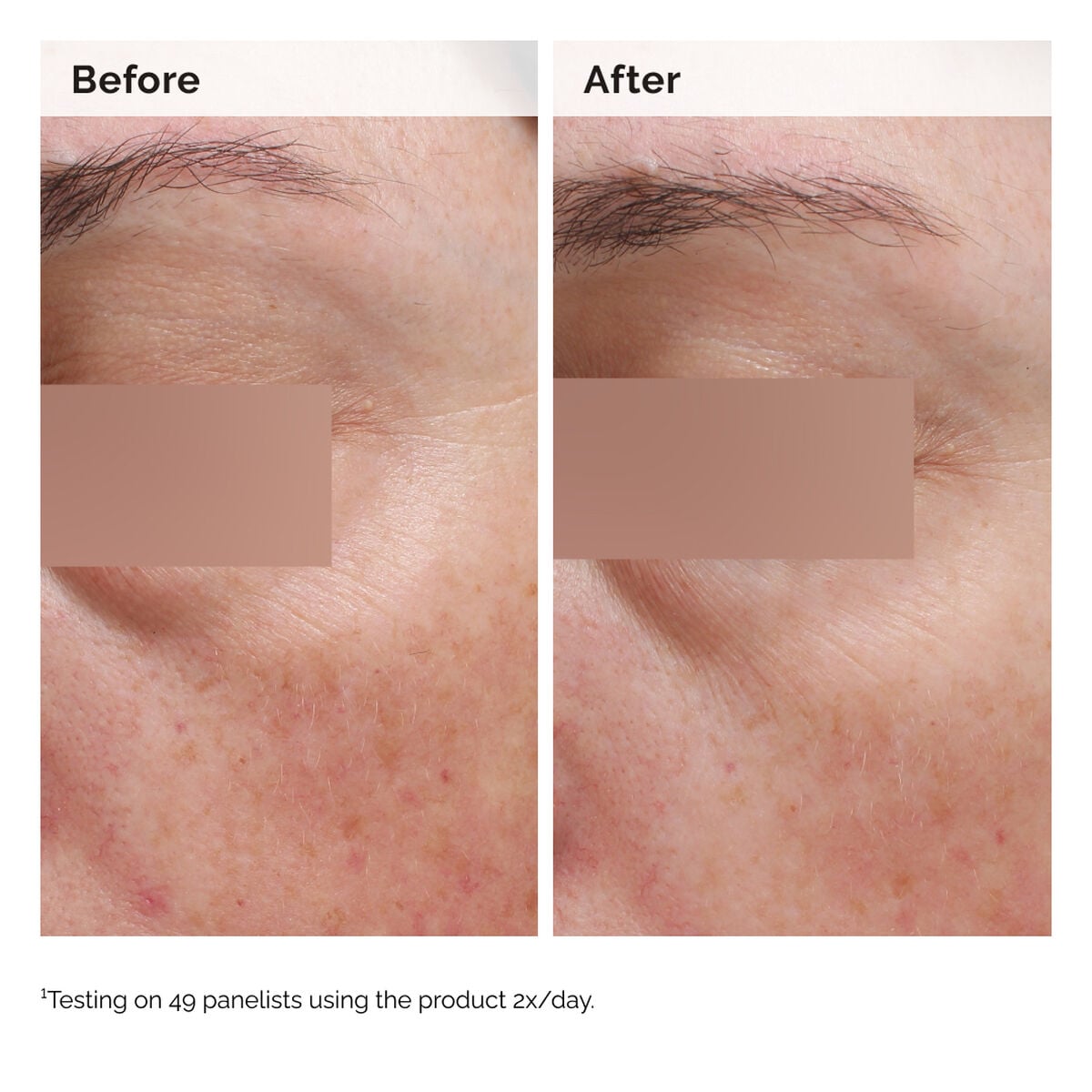 niacinamide-5-face-and-body-emulsion-h4 2024-08-23-ORD-Nia-5pct-Face-Body-B-A-Elasticity-Global-02-1x1.jpg