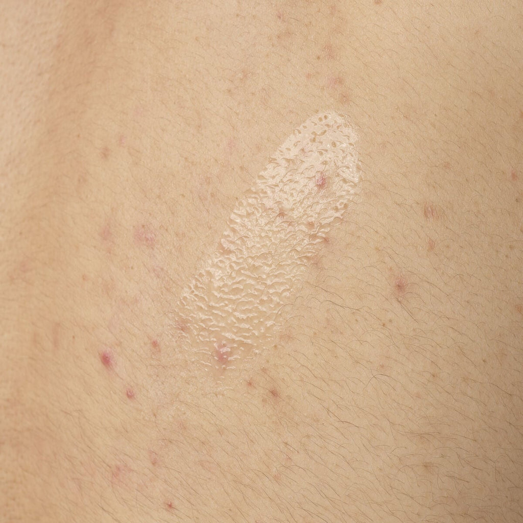 salicylic-acid-0-5-body-serum-v2 ORD-salicylic-acid-05-body-240ml-application.jpg