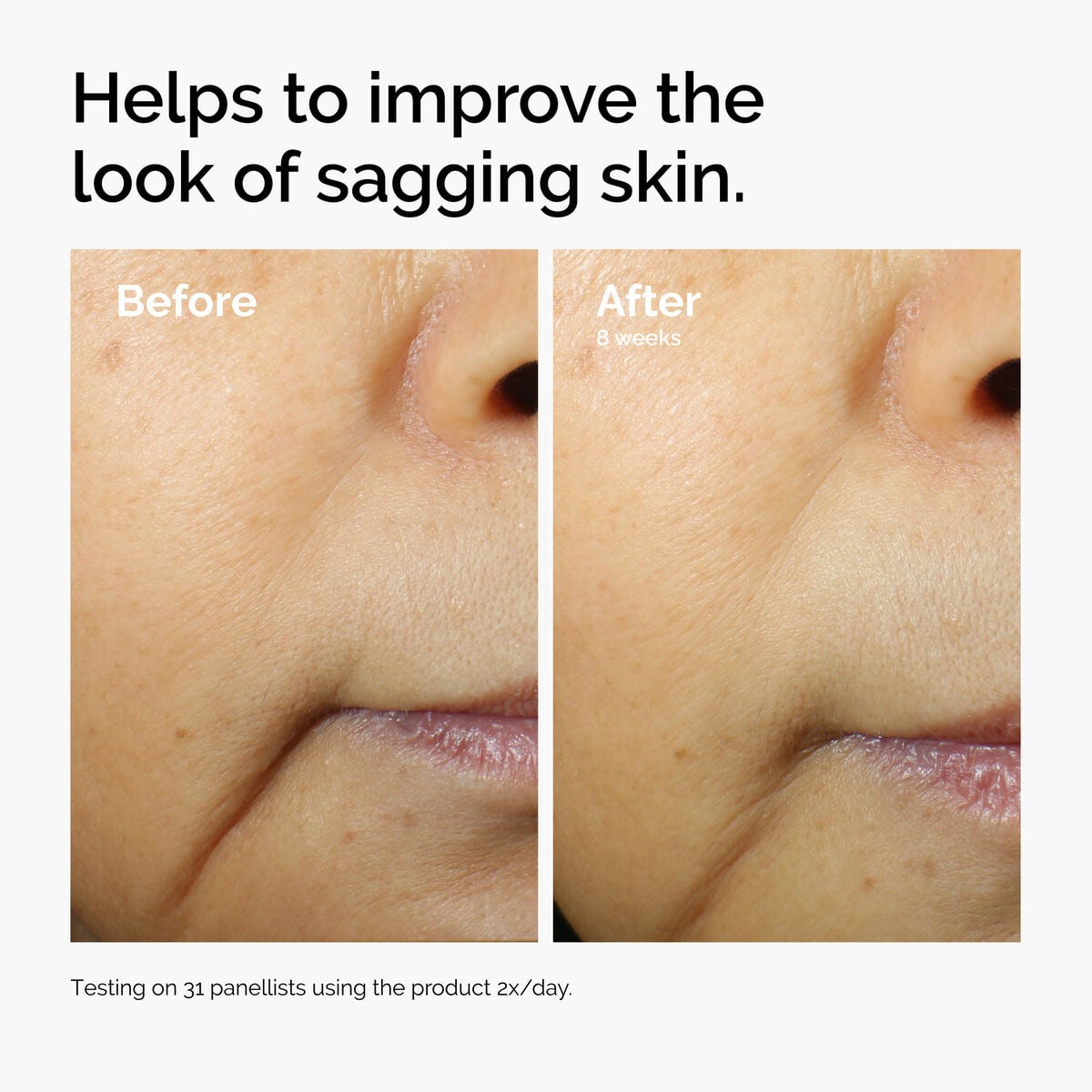 caffeine-3-escin-1-face-serum-u3 ord-caffeine-3pct-escin-1pct-face-serum-before-after-sagging.jpg