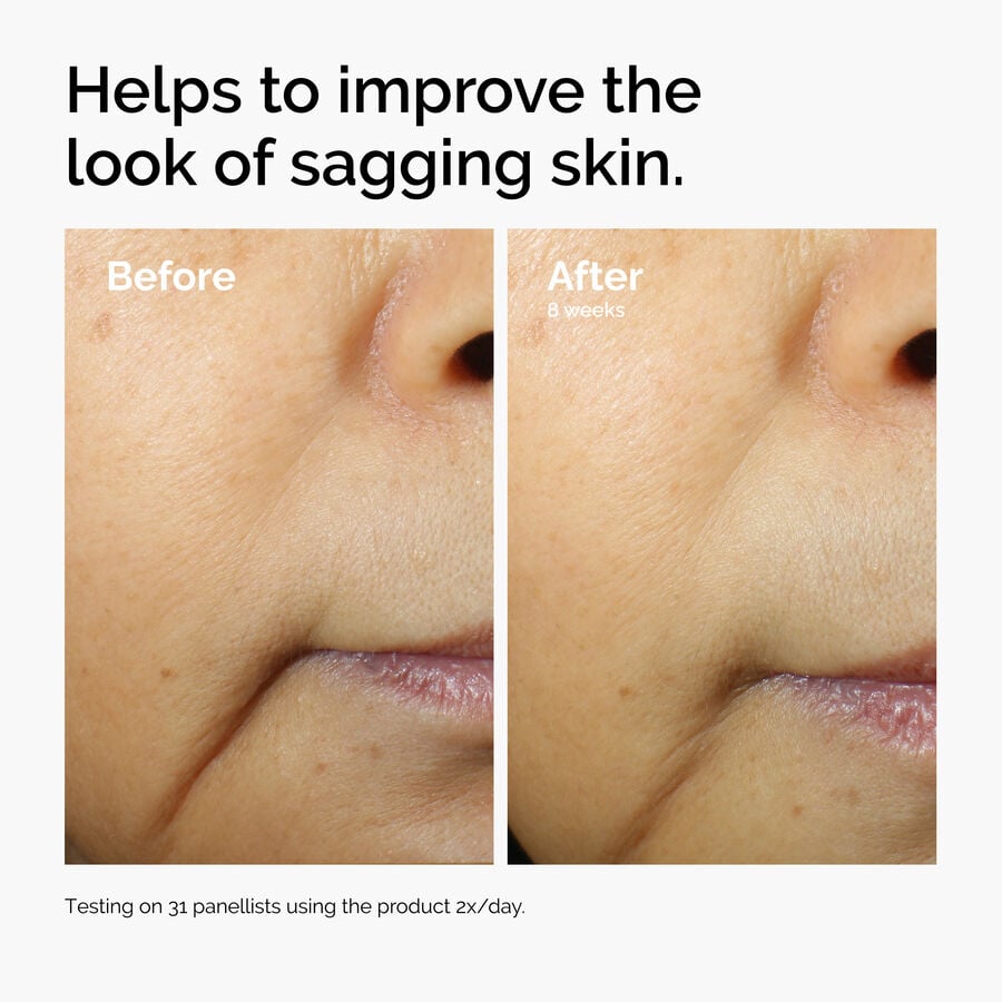 caffeine-3-escin-1-face-serum-u3 ord-caffeine-3pct-escin-1pct-face-serum-before-after-sagging.jpg
