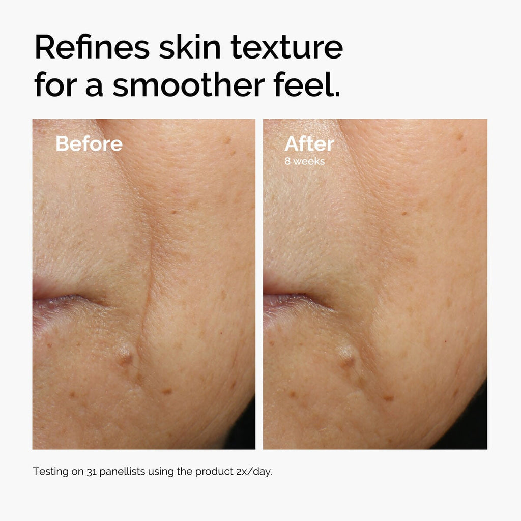 caffeine-3-escin-1-face-serum-u3 ord-caffeine-3pct-escin-1pct-face-serum-before-after-texture.jpg