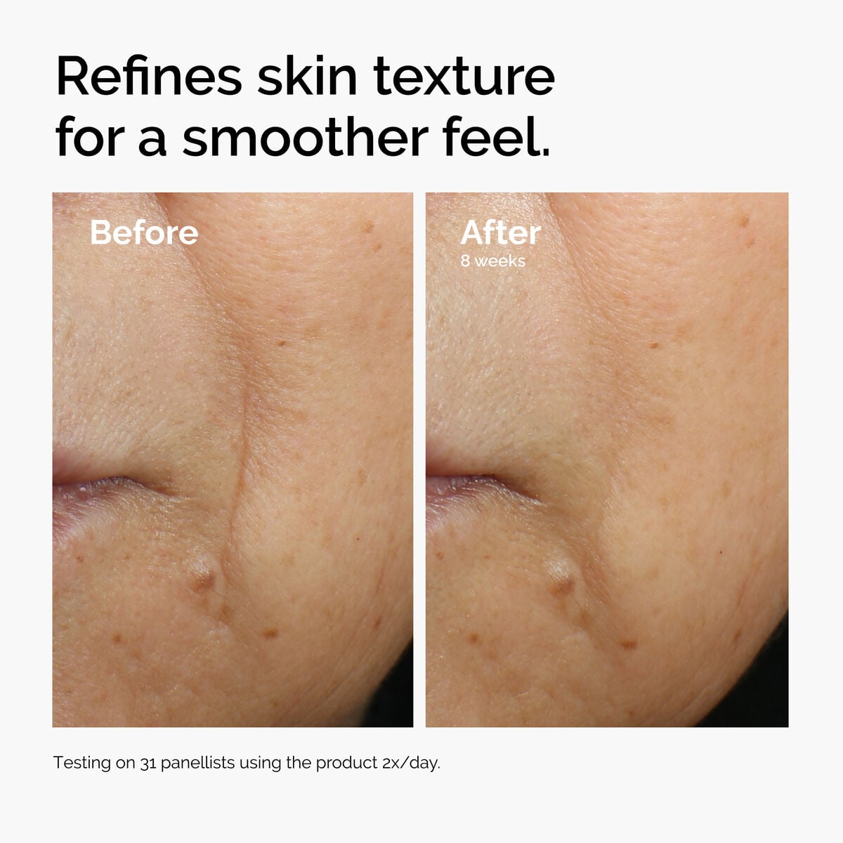 caffeine-3-escin-1-face-serum-u3 ord-caffeine-3pct-escin-1pct-face-serum-before-after-texture.jpg