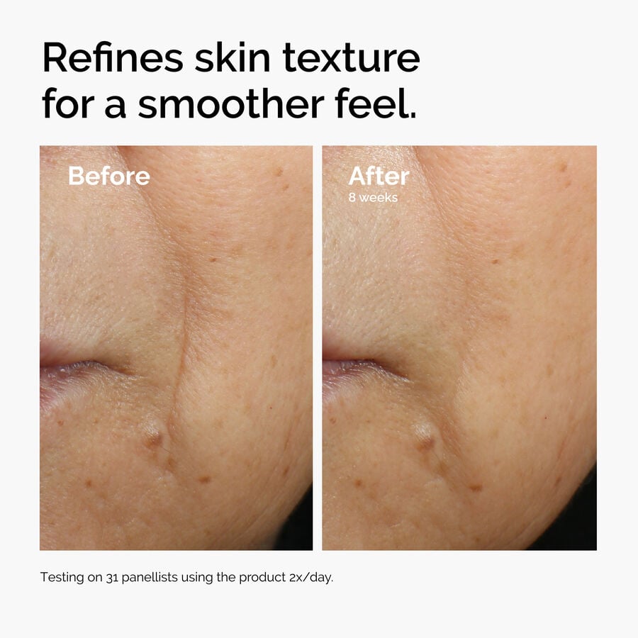 caffeine-3-escin-1-face-serum-u3 ord-caffeine-3pct-escin-1pct-face-serum-before-after-texture.jpg