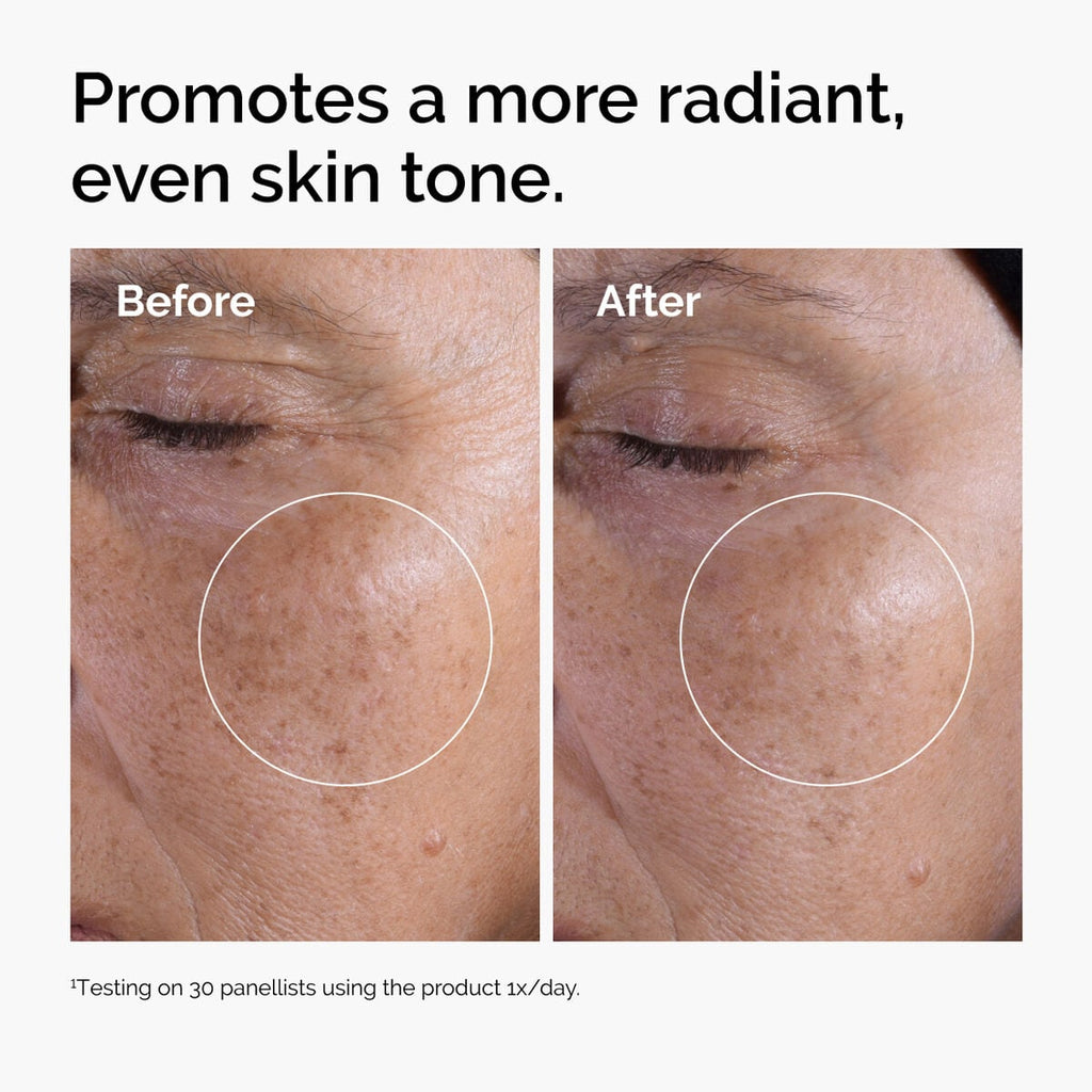 glycolic-acid-7-exfoliating-toner-t6 ord-glycolic-before-after-radiance.jpg