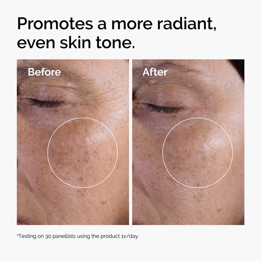 glycolic-acid-7-exfoliating-toner-t6 ord-glycolic-before-after-radiance.jpg
