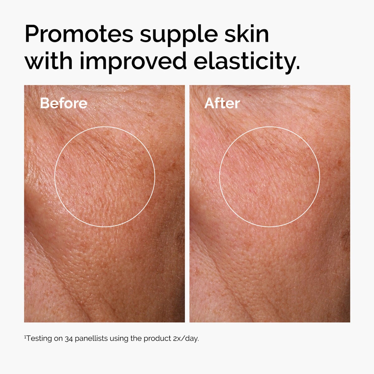 hyaluronic-acid-2-b5-with-ceramides-c4 ord-hyaluronic-acid-2pct-b5-hydrating-serum-before-after-elasticity.jpg