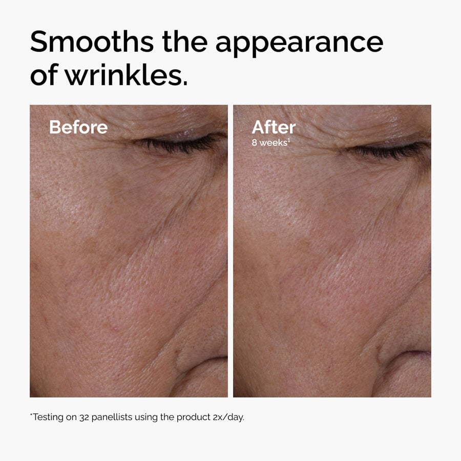 multi-peptide-ha-serum-v7 ord-multi-peptide-ha-serum-wrinkles-before-after.jpg
