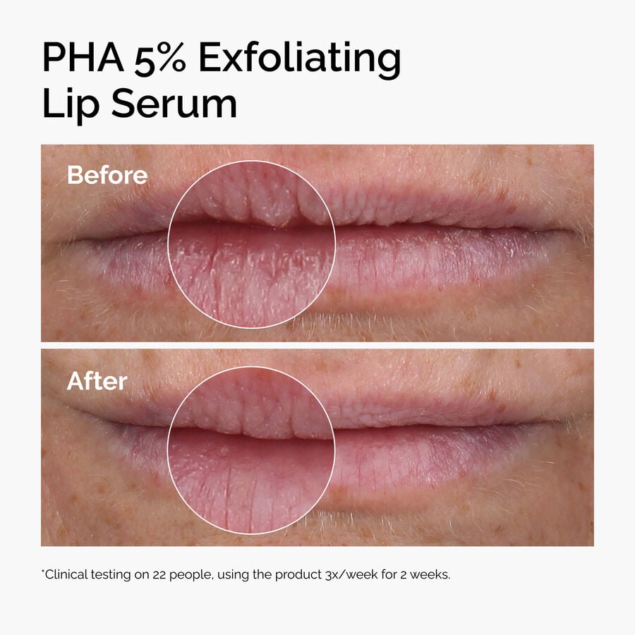pha-5-exfoliating-lip-serum-o0 ord-pha-5pct-lip-exfoliating-serum-before-after.jpg